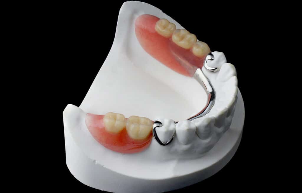 partial dentures